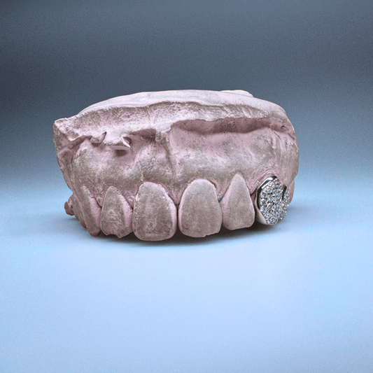 "Diamond Duo" – Double Iced - Out Grillz - Soi & Co. - 